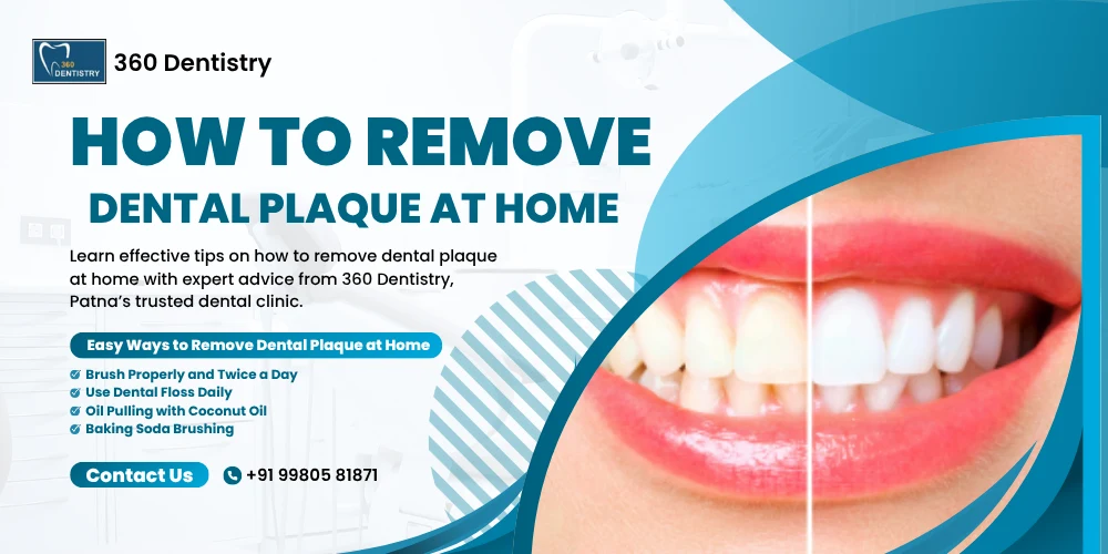 Image illustrating methods for removing dental plaque at home, presented by 360 Dentistry, Patna dental clinic.